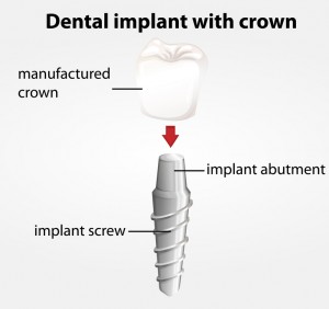 Dalton dental restorations