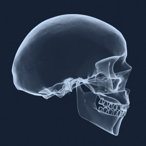 Dalton dental implants