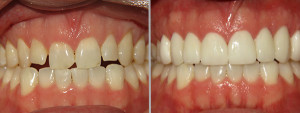 Dalton cosmetic dentistry