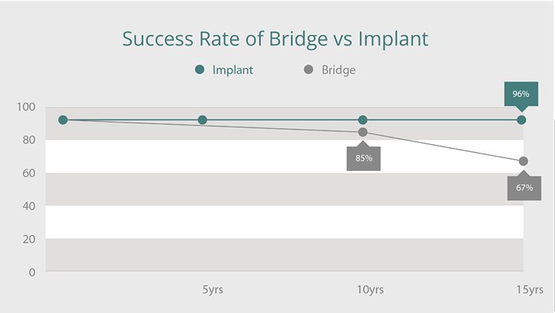 success rate of bridge vs implant