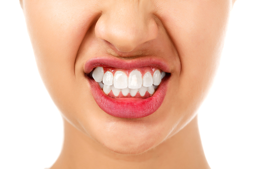 woman grinding her teeth exhibiting symptoms of bruxism